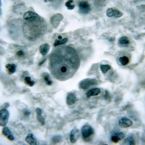 Agyevő amőba Párkányban: Milyen gyakori jelenség, és hogyan védekezhetünk ellene?

Az agyevő amőba, hivatalos nevén Naegleria fowleri, egy rendkívül ritka, de potenciálisan halálos szabadon élő amőba, amely elsősorban meleg vizekben, például tavakban és f